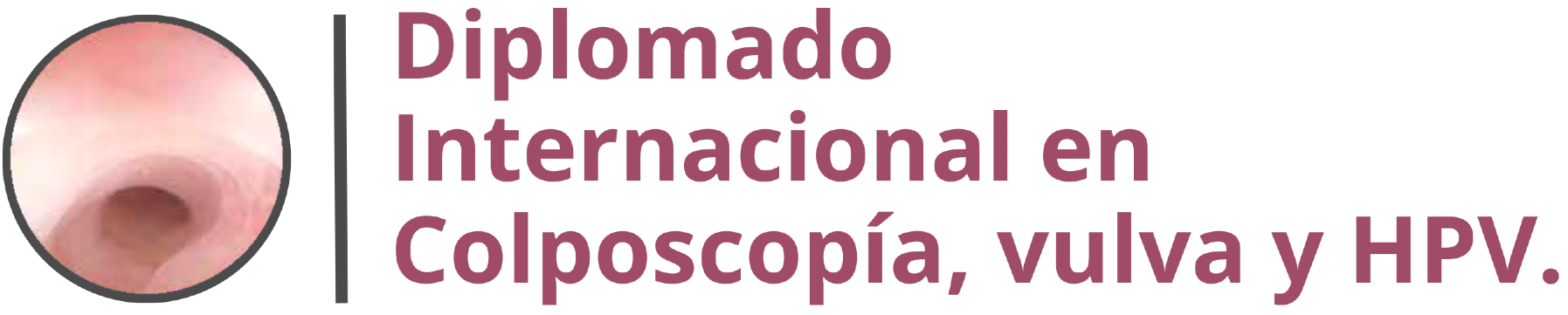 Diplomado Internacional en Colposcopia, Vulva y HPV